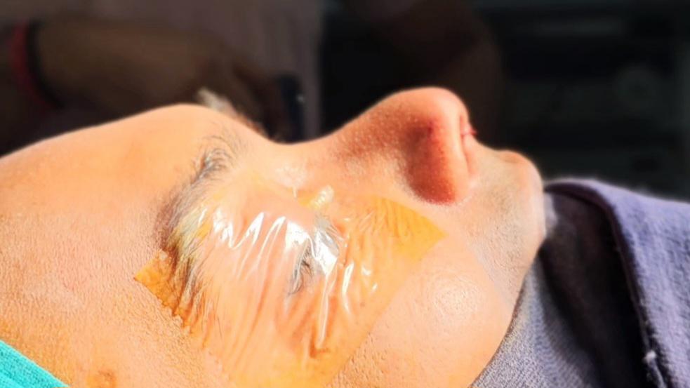 Pre-Op Details